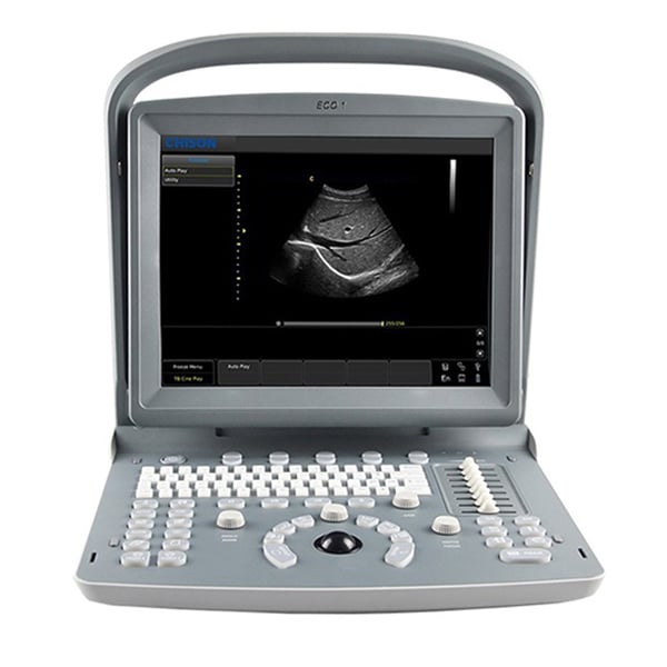 Chison ECO1 Portable Ultrasound Machine